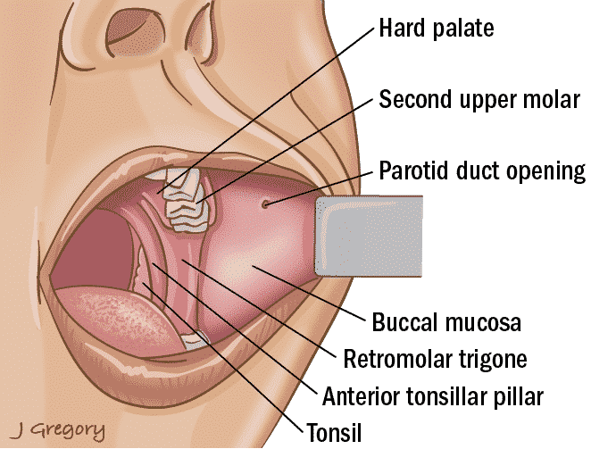 parotid duct, mouth, oral cavity, hard palate, second upper molar, parotid duct opening, buccal mucosa, retromolar trigone, anterior tonsillar pillar, tonsil