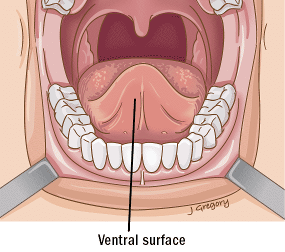 underside tongue anatomy