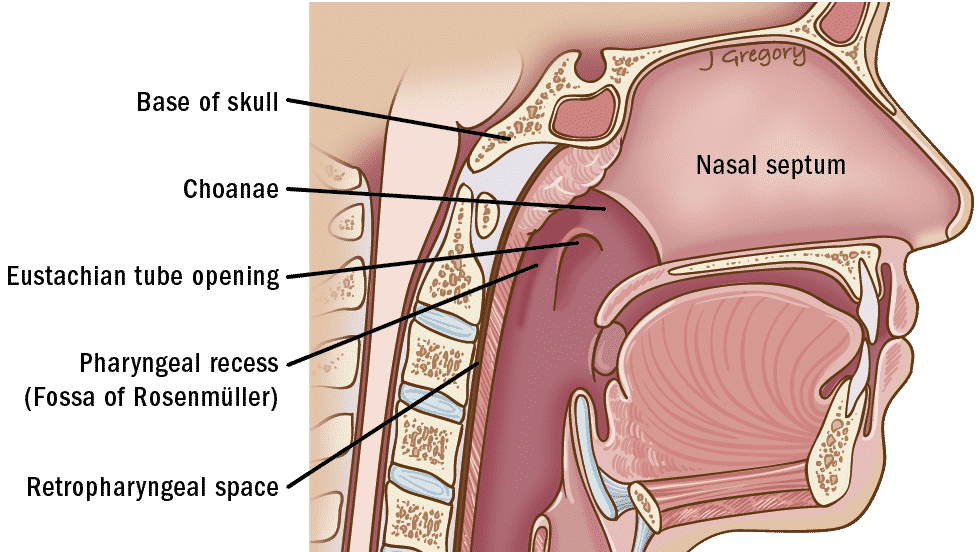 Carcinoma nasofaríngeo - Nasofaringe