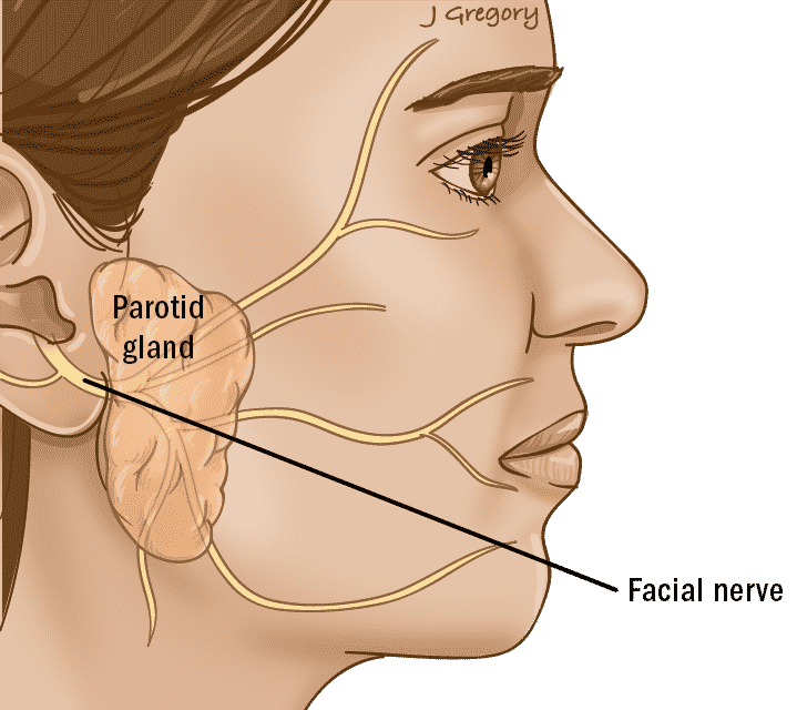 Поврежден лицевой нерв. Околоушная железа анатомия. Лицевой нерв. Лицевой нерв околоушная железа.
