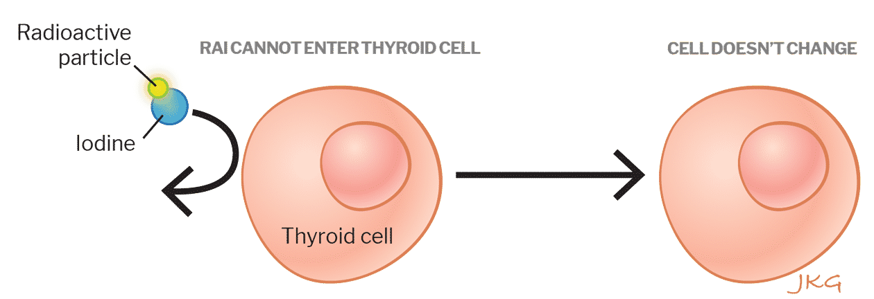 Cáncer de tiroides - Terapia