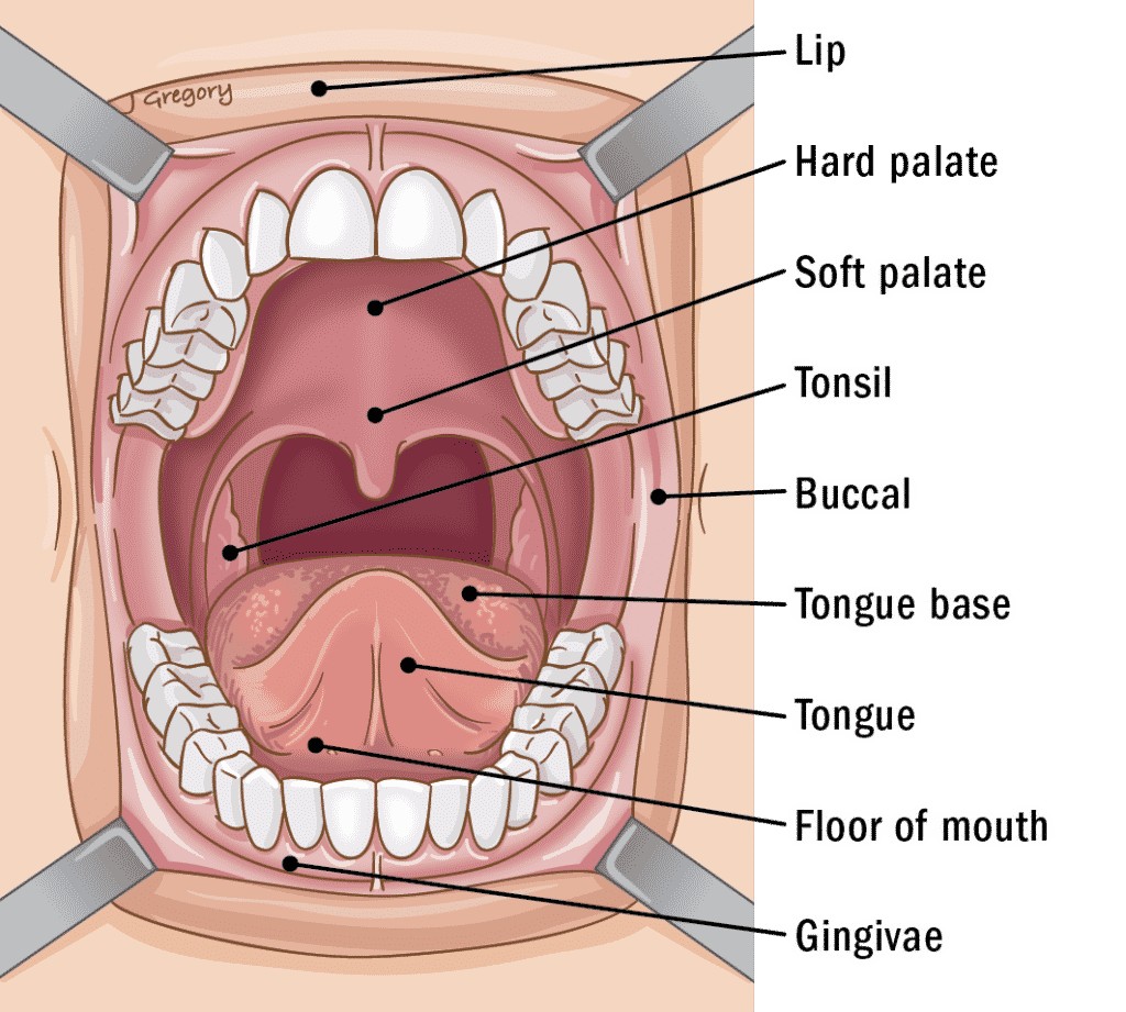 Tooth - Oral cancer