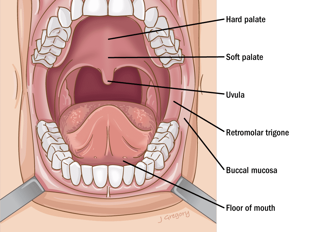 Hard palate - soft palate - uvula - retromolar trigone - buccal mucosa - floor of mouth
